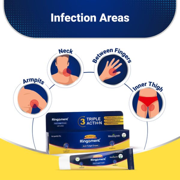 Medisynth Ringoment Anti-Fungal Cream 20g